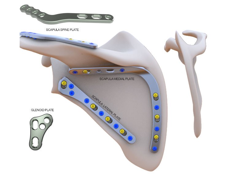 Orthopedics Plates